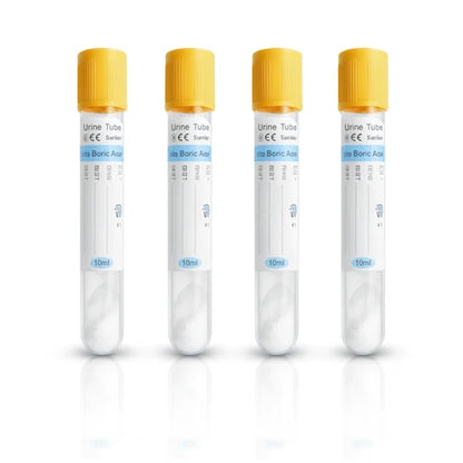 Vacuum Urine Tube, Yellow Cap, 1% Boric Acid, 16*100mm