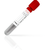 Vacuum Blood Collection Tube – Red Top, 10mL, Clot Activator (Serum Tube)